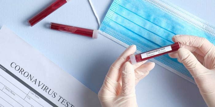 COVID-19 на Закарпатті: майже 100 підтверджених випадків за добу, 2 пацієнтів померли