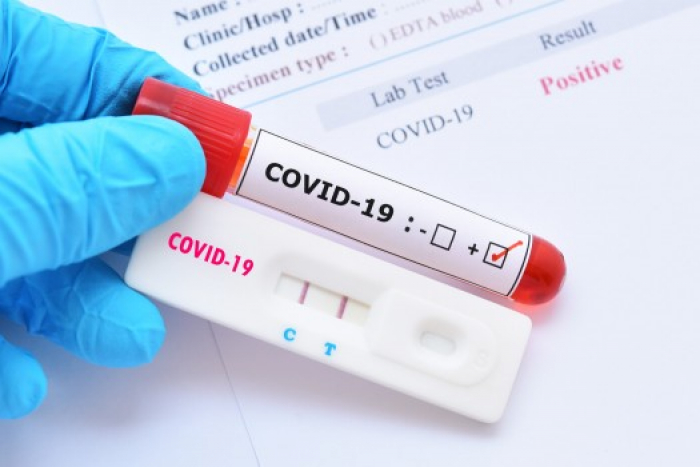 В Ужгороді за добу – 43 нові випадки коронавірусної інфекції