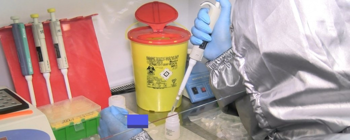 На Закарпатті за добу виявили понад 300 випадків COVID-19