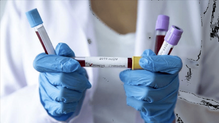 В Ужгороді за добу виявлено 21 випадок коронавірусної інфекції, одна людина померла