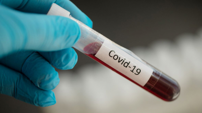 На Закарпатті за добу виявили 62 випадки COVID-19