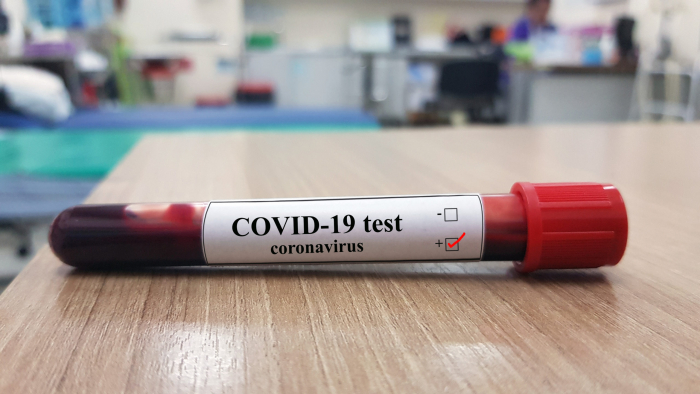 COVID-19 на Закарпатті: за добу – 9 смертей, 218 нових випадків