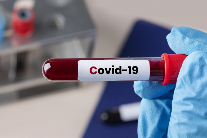 На Закарпатті за добу виявили майже 700 випадків COVID-19 