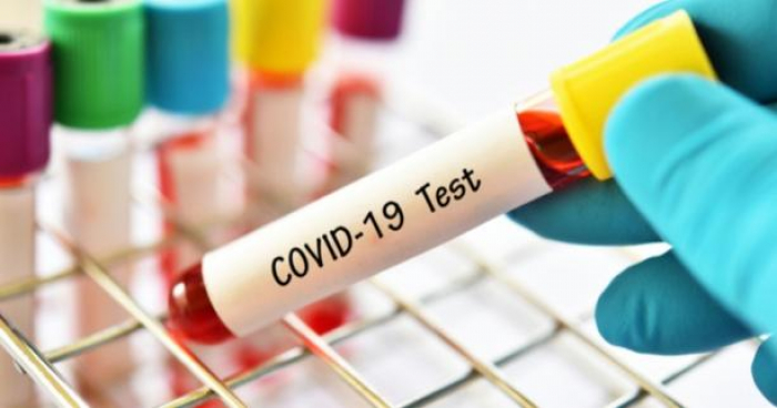 На Закарпатті за добу виявили майже 500 випадків COVID-19