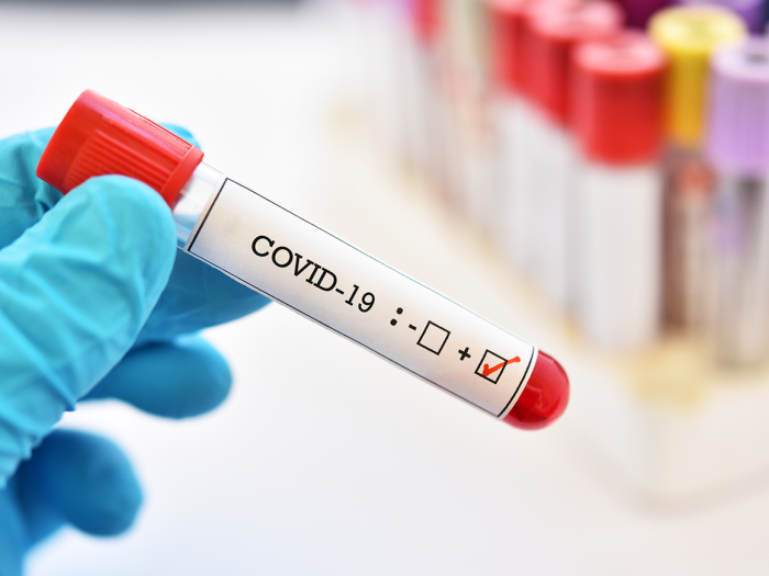 На Закарпатті за добу виявили 60 випадків COVID-19