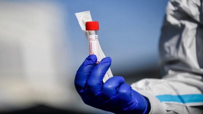 Закарпаття: 389 випадків коронавірусу за добу, померли 13 пацієнтів