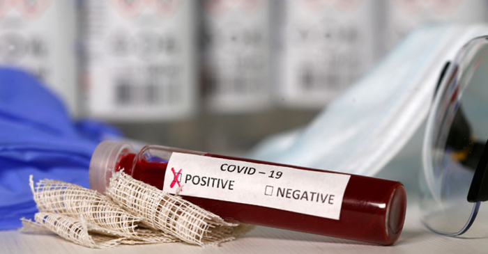 Стало відомо, скільком закарпатцям протягом доби підтверджено COVID-19