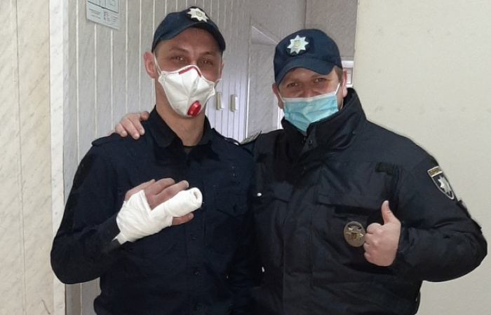 При затриманні злодія ужгородський патрульний зламав палець (ФОТО)