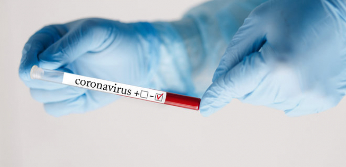 Закарпатті і COVID-19: 157 нових випадків за добу, помер 1 пацієнт