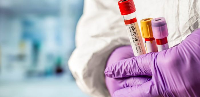 В Ужгороді за минулу добу – 18 нових випадків коронавірусної інфекції