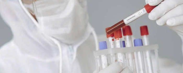 Закарпаття: 651 випадок COVID-19 за добу, померли 22 пацієнти