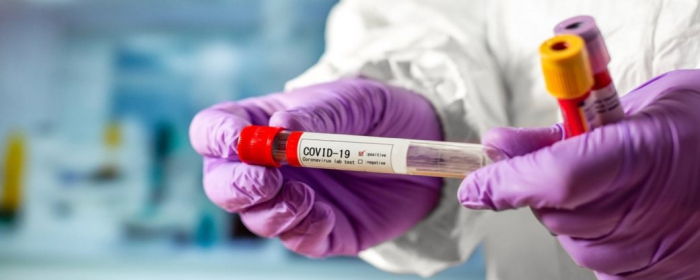 На Закарпатті виявили 106 нових випадків COVID-19. Троє людей померли
