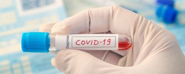 COVID-19 на Закарпатті: 9 нових випадків за добу, 276 людей одужали