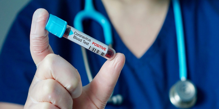 Коронавірус на Закарпатті: діагностовано 38 нових випадків