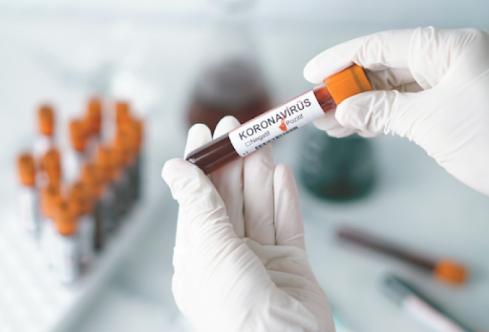 COVID-19 в Закарпатті: 37 випадків за добу, помер 1 пацієнт з підтвердженим вірусом