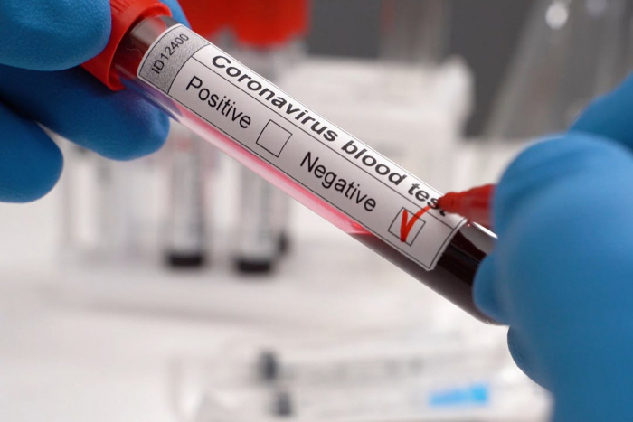 За добу в Ужгороді виявлено 4 нові випадки коронавірусної інфекції
