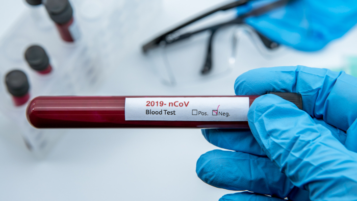 Гарна новина: впродовж доби на Закарпатті не зафіксовано жодного випадку COVID-19