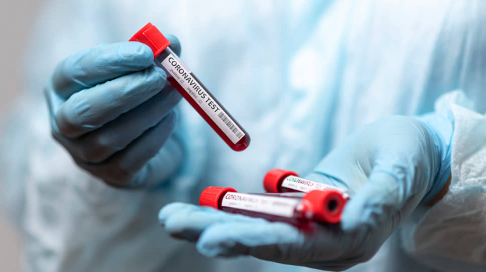 Закарпаття і COVID-19: 8 випадків за добу, помер один пацієнт