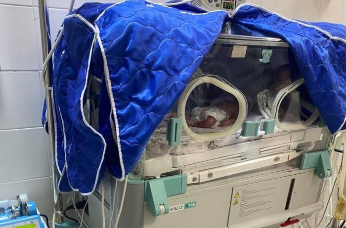 В Ужгороді лікарі успішно здійснили операцію з порятунку трійні (ФОТО)