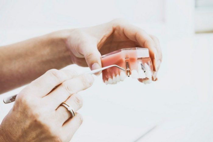 Виды съемного протезирования зубов: какие бывают съемные протезы
