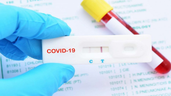 В Ужгороді коронавірус виявили у 10 людей