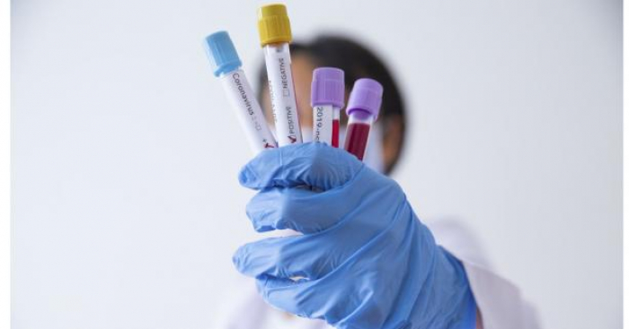 За минулу добу в Ужгороді виявлено 19 нових випадків коронавірусної інфекції