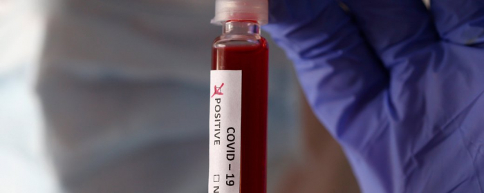 На Закарпатті упродовж доби померли дев'ять людей з COVID-19