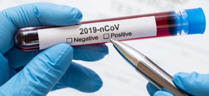 COVID-19 і Закарпаття: 148 нових випадків, 8 людей померло