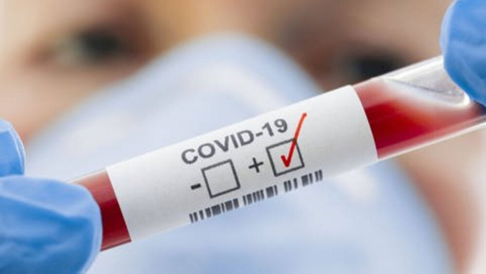 COVID-19 на Закарпатті: 370 підтверджених випадків за добу
