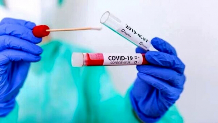 Впродовж доби нових випадків COVID-19 на Закарпатті не виявлено