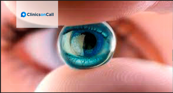 Что такое катаракта и что делать при заболеваниях глаз?
