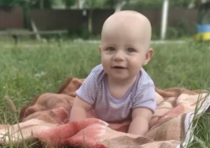 Потрібна допомога: маленький хлопчик із села Олешник потребує термінової операції (ВІДЕО)
