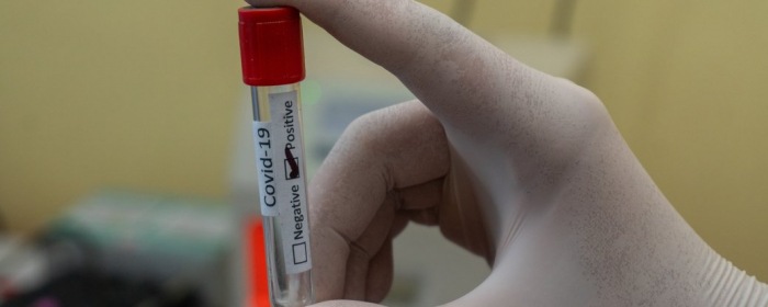 Понад 700 випадків COVID-19 виявили за добу на Закарпатті