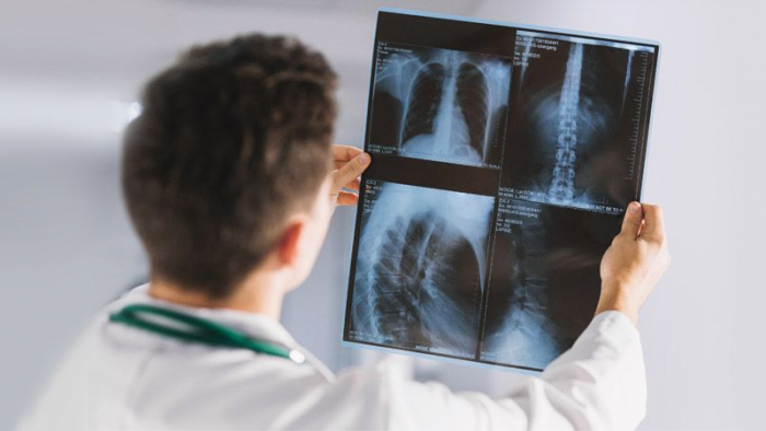 Мобільний рентгенкабінет працюватиме в Ужгороді наступні 2 тижні

