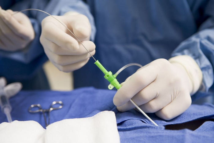 Перші операції зі стентування судин серця провели в Мукачеві (ВІДЕО)