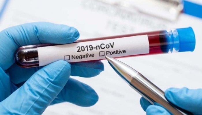 На Закарпатті коронавірус діагностували у 164 людей