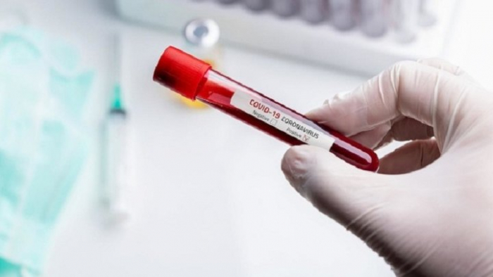 За добу на Закарпатті виявили 108 випадків COVID-19