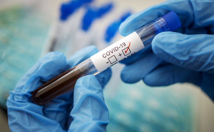 На Закарпатті виявили 234 випадки COVID-19