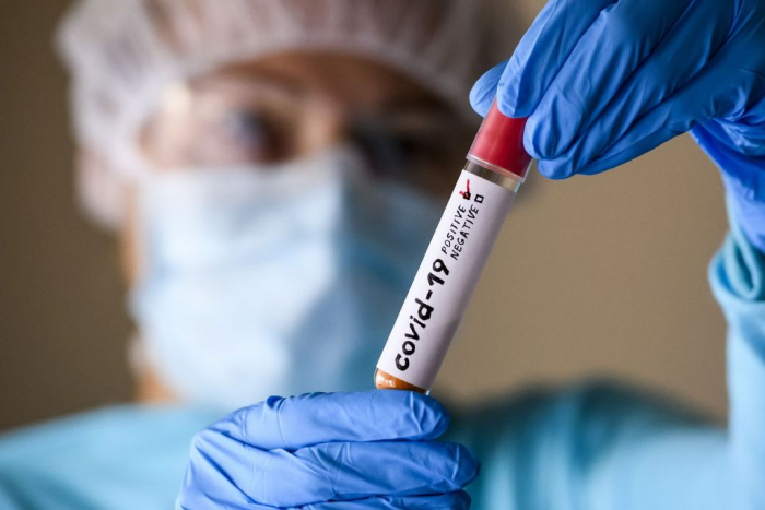 На Закарпатті виявили 29 випадків COVID-19