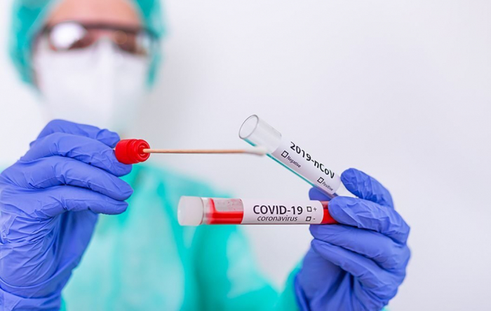 COVID-19 на Закарпатті: за добу виявлено 316 випадків, 1 людина померла