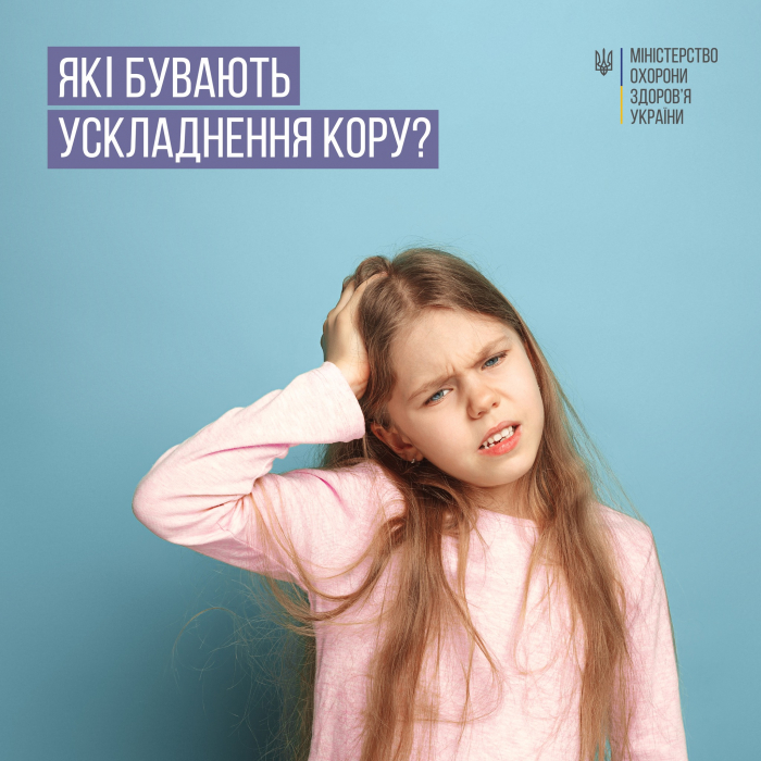 МОЗ інформує: Які бувають ускладнення від кору?