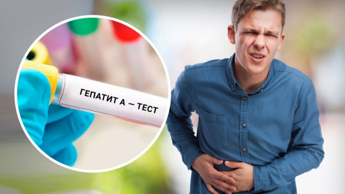 125 випадків вірусного гепатиту А виявили на Закарпатті за дев’ять місяців цього року