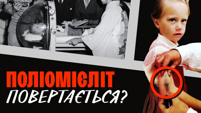 Поліомієліт: чим небезпечний та чи допоможе вакцинація захиститися