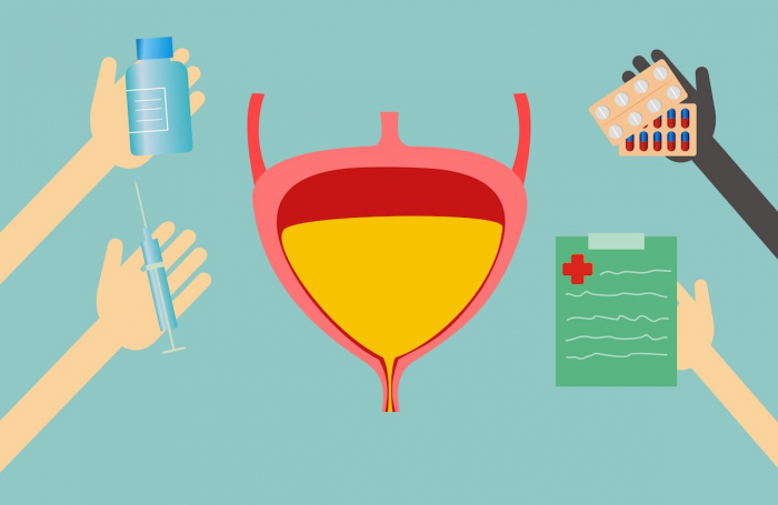 Рак сечового міхура сучасні ризики та методи лікування
