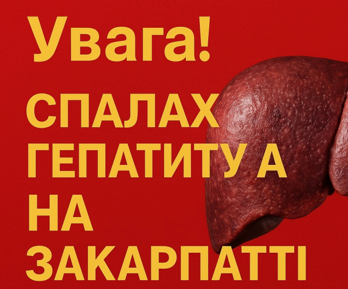 У селі Іза на Закарпатті зафіксували спалах вірусного гепатиту A - фахівці рекомендують утриматися від поїздок туди