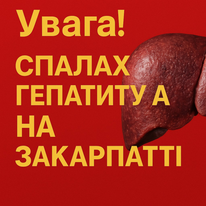 У селі Іза на Закарпатті зареєстровано спалах вірусного гепатиту А: фахівці закликають утриматися від поїздок

