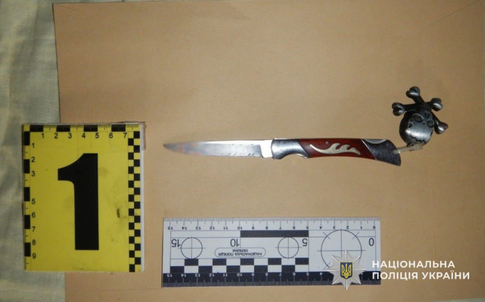 Поліція Мукачева затримала зловмисника, який заподіяв тяжкі тілесні ушкодження своїй знайомій

