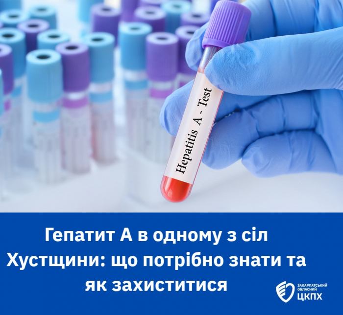 Спалах вірусного гепатиту А в одному із сіл Хустщини: тривають протиепідемічні заходи