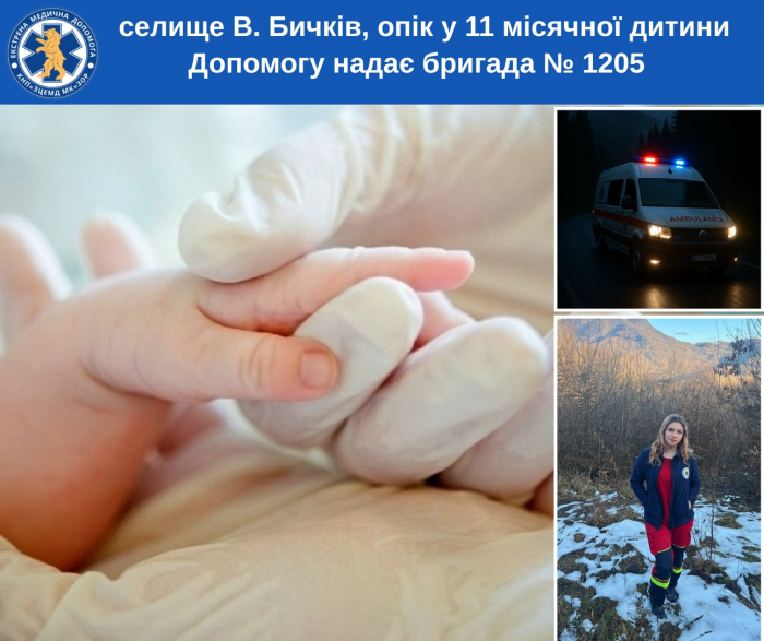 На Рахівщині 11-місячна дитина отримала опіки 40% тіла