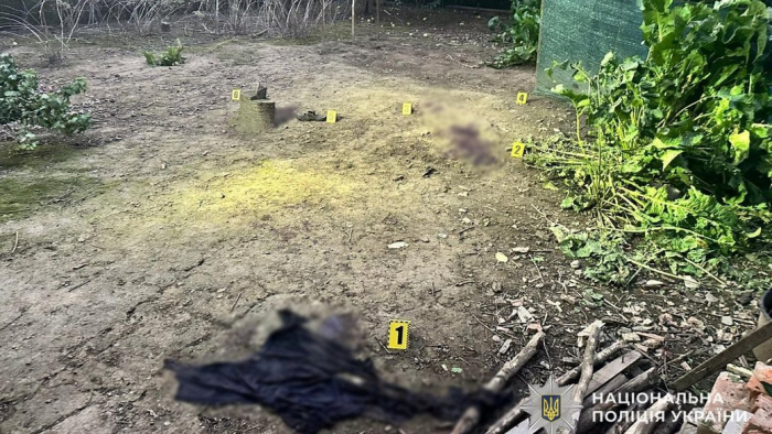У лікарні помер 16-річний закарпатець, який отримав поранення після вибуху гранати